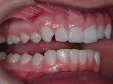 Before - Birmingham Dental