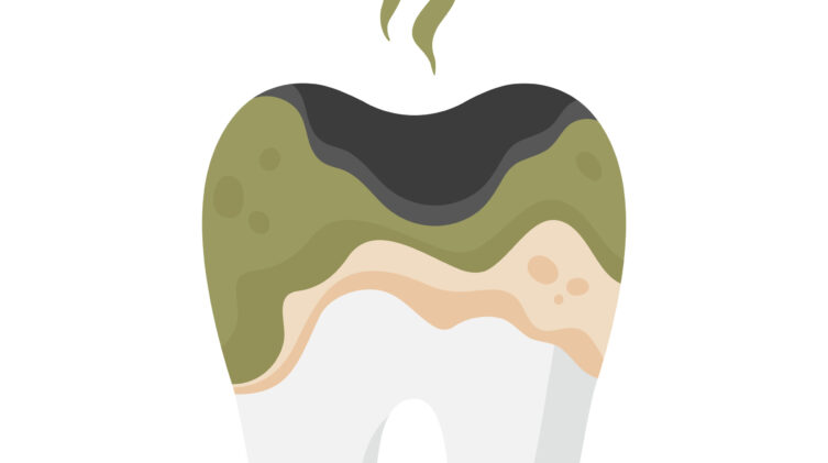 Root tooth