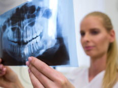 dental bone graft