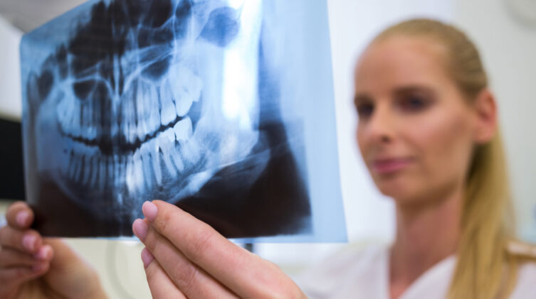 dental bone graft