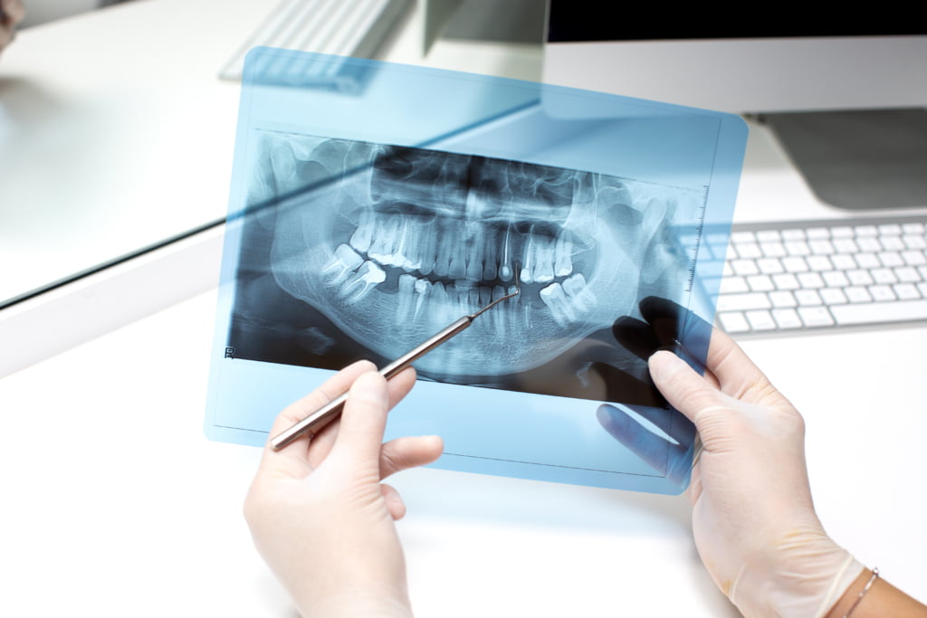 dentist analyses teeth x ray